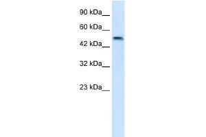 WB Suggested Anti-SBZF3 Antibody Titration:  1. (ZNF695 抗体  (N-Term))