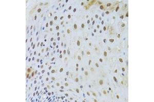 Immunohistochemistry of paraffin-embedded human esophagus using KRT8 Antibody. (KRT8 抗体  (AA 1-483))