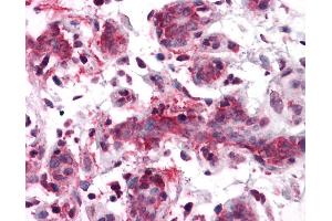 Anti-RSPO1 antibody IHC of human breast.