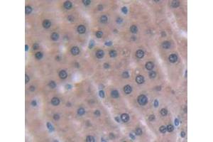Used in DAB staining on fromalin fixed paraffin- embedded Kidney tissue (Angiostatin 抗体  (AA 100-434))