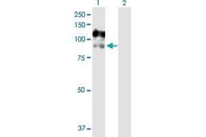 Western Blot analysis of CSF3R expression in transfected 293T cell line by CSF3R MaxPab polyclonal antibody. (CSF3R 抗体  (AA 1-836))