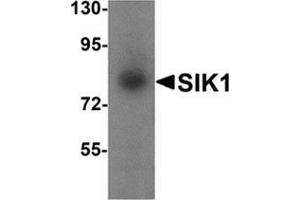 Western blot analysis of SIK1 in human small intestine tissue lysate with SIK1 antibody at 1 μg/ml. (SIK1 抗体  (Center))