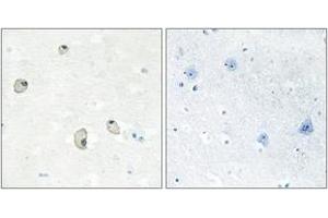 Immunohistochemistry analysis of paraffin-embedded human brain tissue, using CDH22 Antibody. (CDH22 抗体  (AA 111-160))