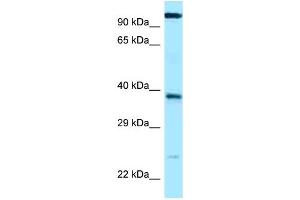WB Suggested Anti-LOC647589 Antibody Titration: 1. (ANHX 抗体  (C-Term))