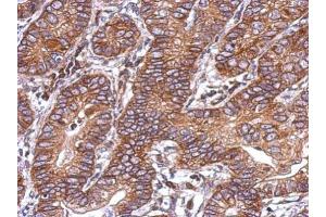 Immunohistochemistry (IHC) image for anti-Activin Receptor Type 1C (ACVR1C) (Center) antibody (ABIN2855632)