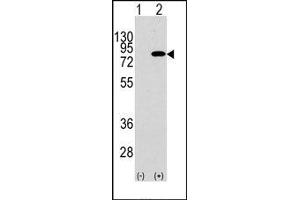 Image no. 1 for anti-Phosphoinositide 3 Kinase, p85 beta (PI3K p85b) (Tyr467) antibody (ABIN360466) (PIK3R2 抗体  (Tyr467))