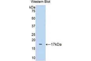 Western blot analysis of the recombinant protein. (TTR 抗体  (AA 20-147))