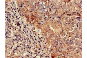 Immunohistochemistry of paraffin-embedded human adrenal gland tissue using ABIN7161691 at dilution of 1:100 (TYK2 抗体  (AA 286-372))