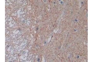 Immunohistochemistry (IHC) image for anti-Protein tyrosine Phosphatase, Receptor Type, B (PTPRB) (AA 1041-1310) antibody (ABIN7443743)
