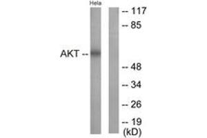 Western blot analysis of extracts from HeLa cells, treated with Insulin 0. (AKT1 抗体  (AA 292-341))