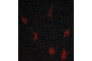 ABIN6268894 staining lovo cells by ICC/IF. (TGFBR1 抗体  (Internal Region))