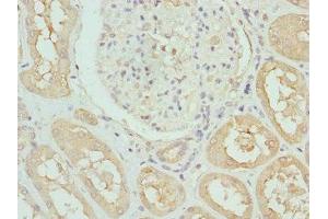 Immunohistochemistry of paraffin-embedded human kidney tissue using ABIN7157806 at dilution of 1:100 (DCXR 抗体  (AA 1-244))