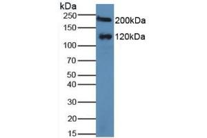 Figure. (Maltase-Glucoamylase (MGAM) (AA 213-392) 抗体)