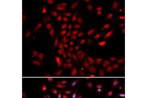 Immunofluorescence analysis of U2OS cells using KPNA4 Polyclonal Antibody (KPNA4 抗体)