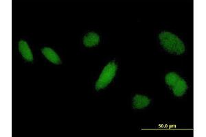 Immunofluorescence of purified MaxPab antibody to DHRSX on HeLa cell. (DHRSX 抗体  (AA 1-330))