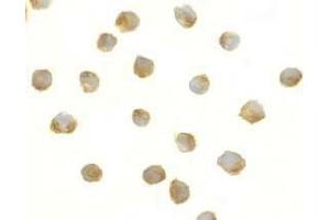 Immunocytochemical staining of DFF40 in Jurkat cells with DFF antibody at 5μg/ml.