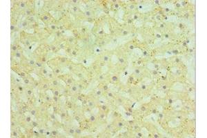 Immunohistochemistry of paraffin-embedded human liver tissue using ABIN7155970 at dilution of 1:100 (HYAL1 抗体  (AA 136-435))