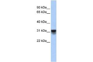 WB Suggested Anti-KDELR3 Antibody Titration:  0. (KDELR3 抗体  (Middle Region))