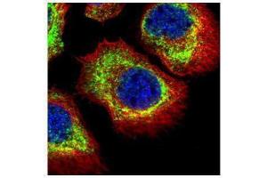 ICC/IF Image Confocal immunofluorescence analysis (Olympus FV10i) of methanol-fixed A431, using alpha Adducin, antibody (Green) at 1:500 dilution. (alpha Adducin 抗体)