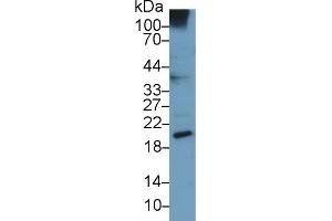 Detection of UCN3 in Human A549 cell lysate using Monoclonal Antibody to Urocortin 3 (UCN3) (UCN3 抗体  (AA 22-161))
