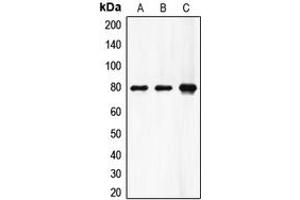 Western blot analysis of Factor XIII A expression in HeLa (A), A549 (B), rat heart (C) whole cell lysates. (F13A1 抗体  (N-Term))