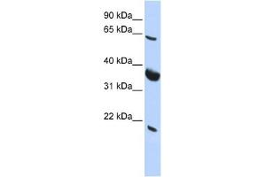 SRPR antibody used at 1 ug/ml to detect target protein. (SRPR 抗体)