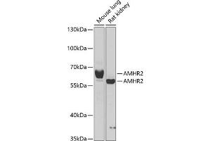 Western blot analysis of extracts of various cell lines, using  antibody  at 1:1000 dilution. (AMHR2 抗体  (AA 18-149))