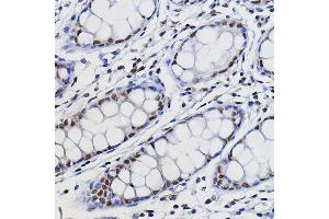 Immunohistochemistry of paraffin-embedded human colon using METTL14 Rabbit pAb (ABIN6131104, ABIN6143759, ABIN6143760 and ABIN6224625) at dilution of 1:100 (40x lens). (METTL14 抗体  (AA 1-210))