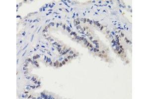 Immunohistochemistry (Paraffin-embedded Sections) (IHC (p)) image for anti-Signal Transducer and Activator of Transcription 3 (Acute-Phase Response Factor) (STAT3) (pSer727) antibody (ABIN7265216)