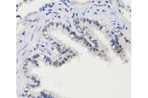 Immunohistochemistry of paraffin-embedded Rat lung using Phospho-Stat3(S727) Polyclonal Antibody at dilution of 1:100 (40x lens). (STAT3 抗体  (pSer727))