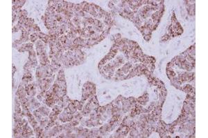 Image no. 1 for anti-Dihydrouridine Synthase 2-Like (DUS2L) (AA 1-199) antibody (ABIN1497929) (DUSL2 抗体  (AA 1-199))