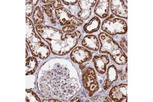 Immunohistochemical staining (Formalin-fixed paraffin-embedded sections) of human kidney with CDC16 polyclonal antibody  shows strong cytoplasmic positivity in cells in tubules. (CDC16 抗体)