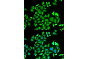 Immunofluorescence analysis of U2OS cell using PSMA3 antibody. (PSMA3 抗体)