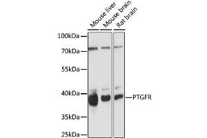 Western blot analysis of extracts of various cell lines, using PTGFR antibody. (PTGFR 抗体)