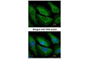 Immunofluorescence (IF) image for anti-Protein Phosphatase 1, Catalytic Subunit, gamma Isoform (PPP1CC) (Center) antibody (ABIN2856137)