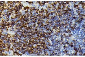 Immunohistochemistry (Paraffin-embedded Sections) (IHC (p)) image for anti-Apolipoprotein C-III (APOC3) antibody (ABIN7257635)
