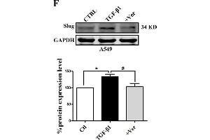 Slug is regulated by the co-transcriptional complex YAP1/TEAD in the EMT program of A549 cells. (GAPDH 抗体)