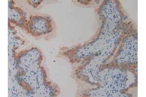 Detection of PLA2R1 in Mouse Vas Deferens Tissue using Polyclonal Antibody to Phospholipase A2 Receptor 1 (PLA2R1)