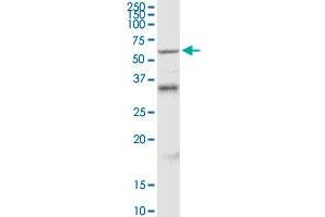 MDM4 MaxPab rabbit polyclonal antibody. (MDM4-binding Protein 抗体  (AA 1-490))