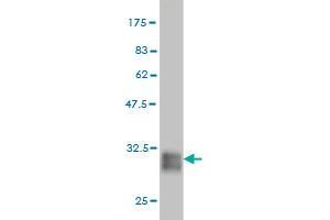 Western Blot detection against Immunogen (31. (POMZP3 抗体  (AA 64-116))