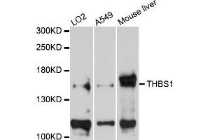 Western blot analysis of extracts of various cells, using THBS1 antibody. (Thrombospondin 1 抗体)