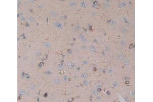 Used in DAB staining on fromalin fixed paraffin- embedded brain tissue (CHRNA10 抗体  (AA 25-425))