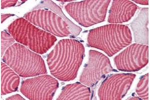 Human Skeletal Muscle (formalin-fixed, paraffin-embedded) stained with TBC1D4 antibody ABIN351486 at 3. (TBC1D4 抗体  (AA 825-837))