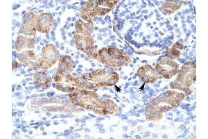 DMRTA2 antibody was used for immunohistochemistry at a concentration of 4-8 ug/ml to stain Epithelial cells of renal tubule (lndicated with Arrows) in Human Kidney. (DMRTA2 抗体  (C-Term))