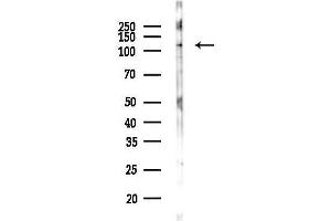 anti-Salt-Inducible Kinase 2 (SIK2) (pThr484) antibody