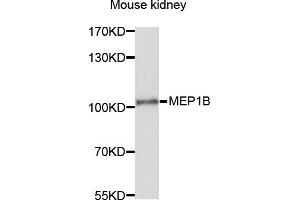 Western blot analysis of extracts of mouse kidney, using MEP1B antibody (ABIN6003791) at 1/1000 dilution. (Meprin B 抗体)