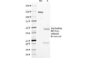 SDS-PAGE Analysis Purified Erythrocyte Specific Mouse Monoclonal Antibody (SFL23. (Erythrocyte Specific Antigen 抗体)