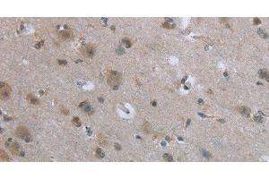 Immunohistochemistry of paraffin-embedded Human brain tissue using EGFL8 Polyclonal Antibody at dilution 1:40 (EGFL8 抗体)