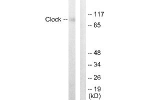 Immunohistochemistry analysis of paraffin-embedded human skeletal muscle tissue using Clock antibody. (CLOCK 抗体  (Internal Region))