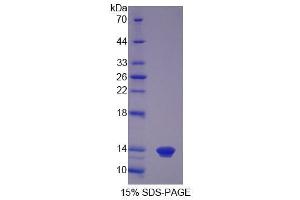 Image no. 1 for S100 Calcium Binding Protein A12 (S100A12) (AA 2-92) protein (His tag) (ABIN6238588) (S100A12 Protein (AA 2-92) (His tag))
